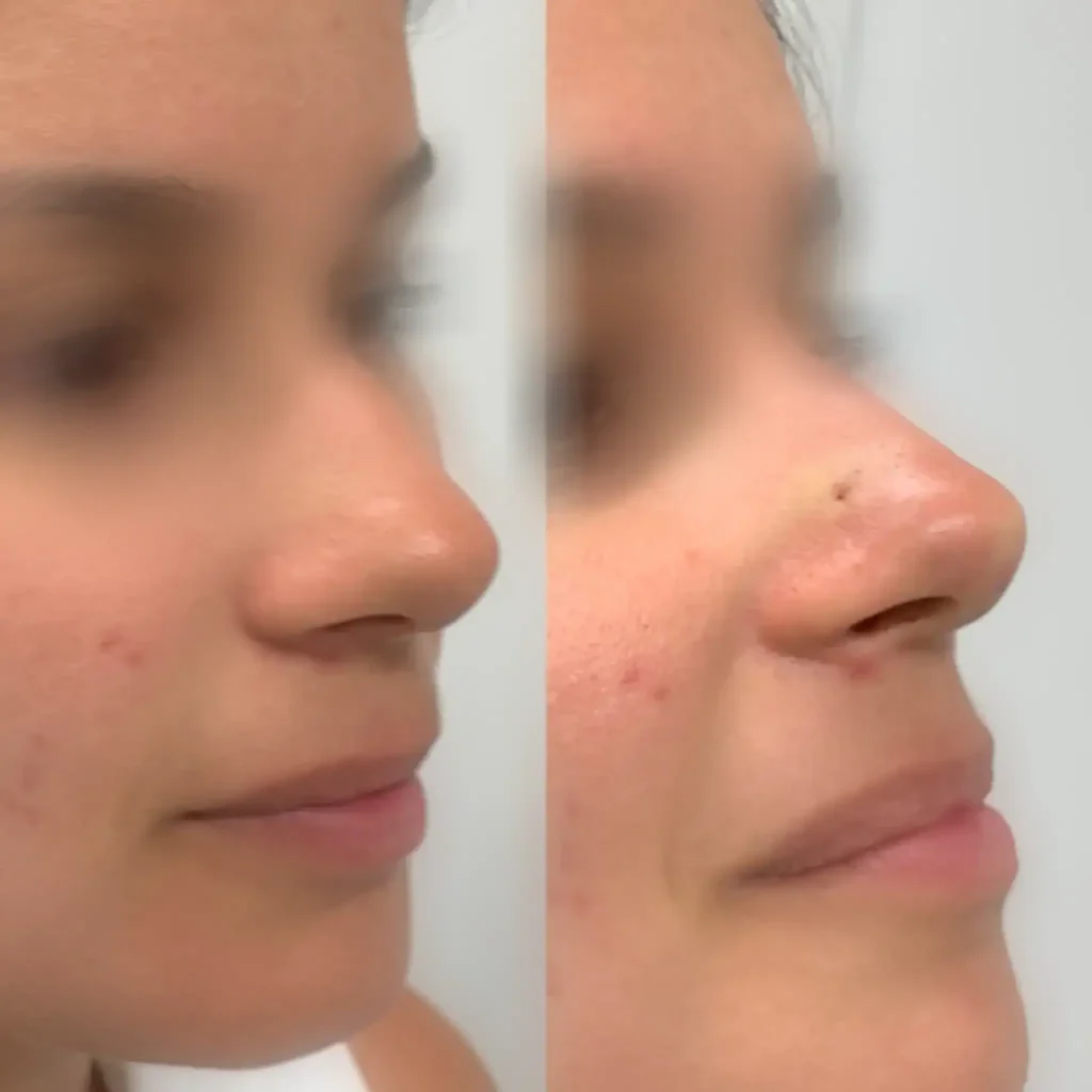 Private aesthetic consultation at Vitalumina London