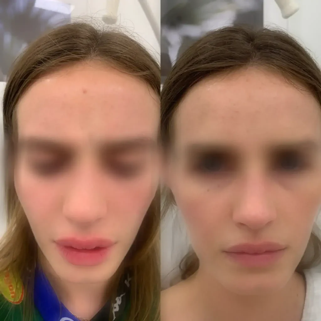 Dr Gregorio De Carvalho aesthetic doctor in London consultation setting