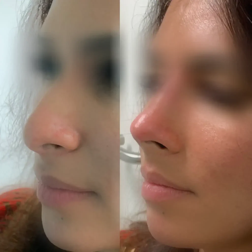 Vitalumina medical aesthetics clinic in London